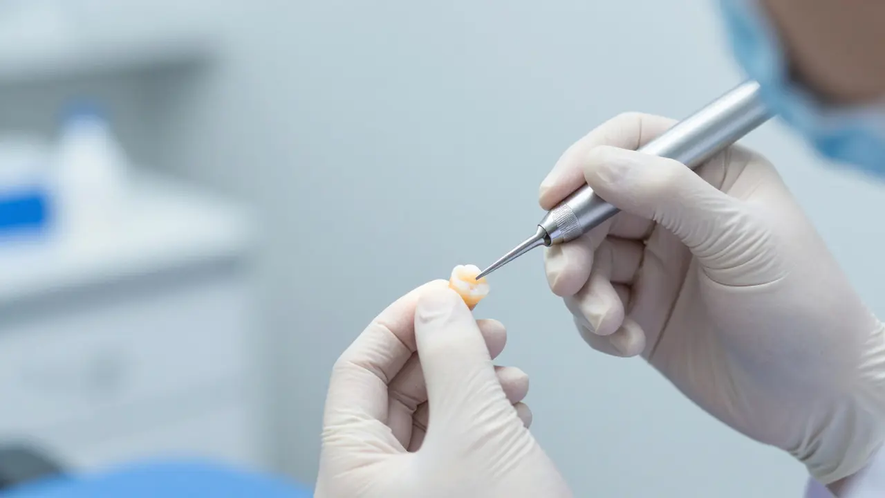 Kolik stojí kompozitní fazety? Průvodce cenami a výběrem nejlepší nabídky