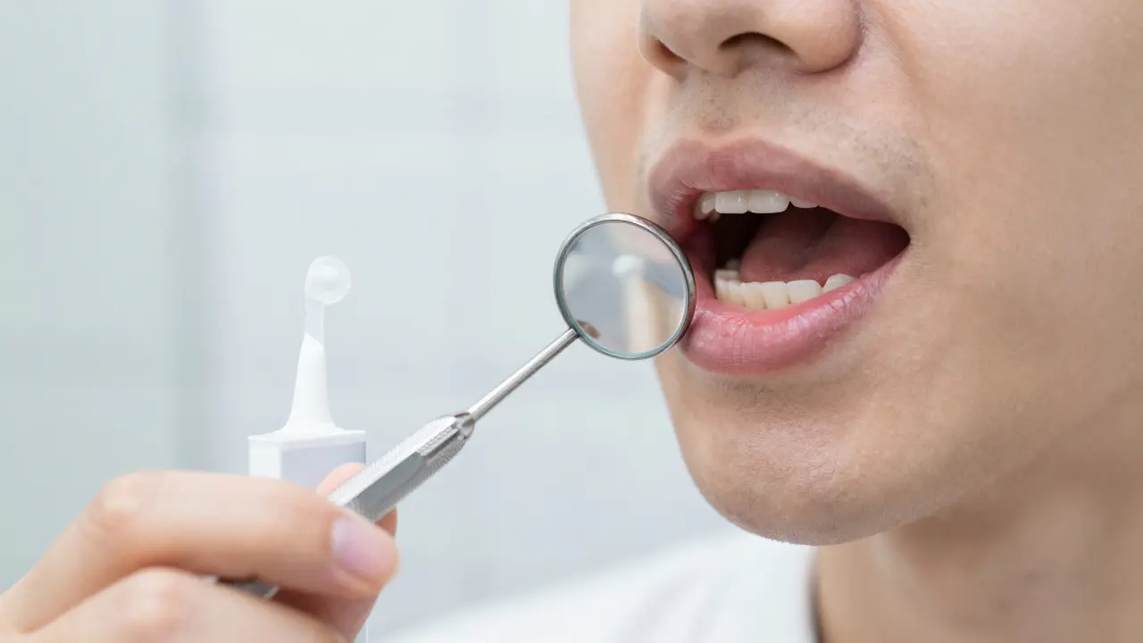 Jak dentální zrcátko pomůže při bělení zubů: Kontrola, přesnost a bezpečí